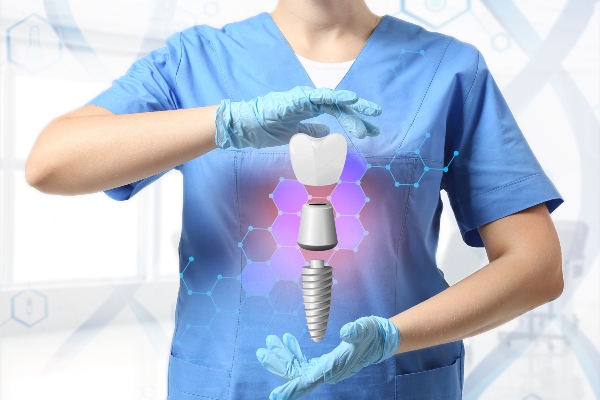 5 FAQs About Dental Implants from Lakeview Dental in Coeur d'Alene, ID