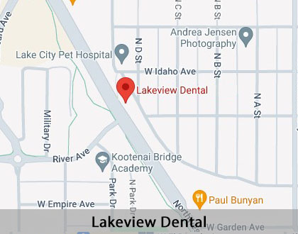 Map image for Dental Implants in Coeur d'Alene, ID