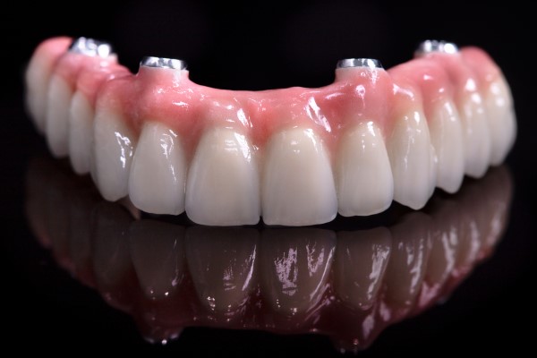 Reasons To Consider Implant Dentures To Replace Multiple Missing Teeth