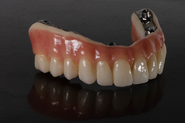 Advantages And Drawbacks Of Implant Supported Dentures