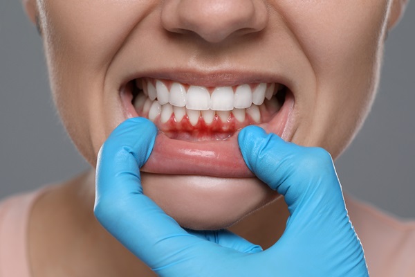 How A General Dentist Uses Periodontics To Save Your Smile